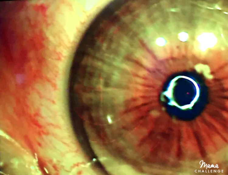 eye5
