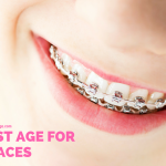 Best Age For Braces